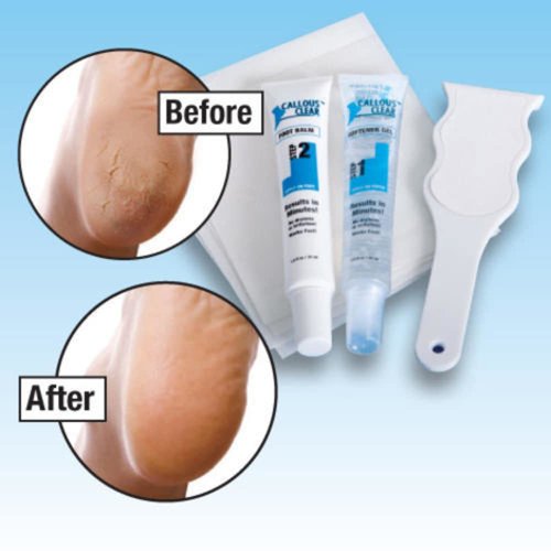 Callous Clear Foot Treatment Kit Deluxe Foot Treatments Cream Heel Balm Scraper/File for Smooth Soft Finish Feet