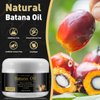 Generic 100% Natural Raw Batana Oil for Hair Growth, Dr. Sebi Hair Oil from Honduras, Prevent Hair Loss, Eliminates Split Ends for Men & Women