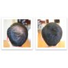 Caboki Healthful Powder Volumizer for Men & Women: Thinning Hair Solution for Root Touch Up, Hairline & Edges, Covering Hair Loss, Bald Spots & Gray Hair - TALC-Free,