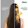 Dabur Amla Hair Oil - Nourishing Indian Oil for Men & Women, for Healthy, Moisturized Hair and Scalp (300ml)