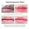 20Pcs Moisturizing/Plumping Lip Mask, Restores Moisture Mask for Dry Lips and Lines Overnight Care, Gel Treatment Masks ​ (Pink)