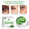 sefudun Aloe Veoe Eye Patches,Hydrogel Under Eye Masks for Dark Circles,Anti Wrinkle Treatment,Under Eye Gel Pads,Eye Mask for Puffy Eyes, Skincare,Hydrating | 60 Pieces/30 Pairs