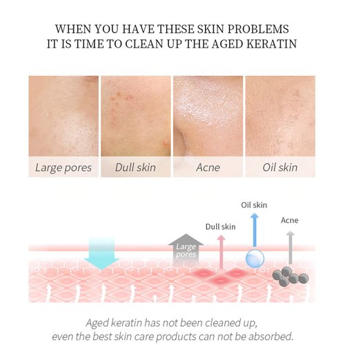 Chamomile Exfoliating Gel Deep Cleansing Pores Shrink Pores Gentle Exfoliation Tighten Moisturize Hydrating Repair Soothe Soften Improve Skin Tone 60g