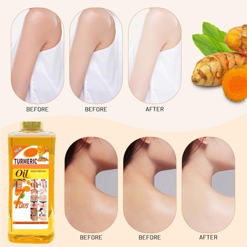 Rliolouo Soft 7 oil, Soft 7 Turmeric Oil, Soft 7 Turmeric Honey Soap Bar, Soft 7 Turmeric And Honey Soap, Turmeric Oil For Skincare, Natural Moisturizing & Smoothing Body Oil For All Skin Types