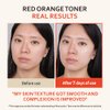 T'else Red Orange Niacinamide Toner 150ml, 5.2 Fl.oz, Tone Up Vitalizing Facial Essence, Smoothening Skin Texture Watery Toner with Exfoliation, PHA Care with Vitamin C & Panthenol, Korean Skin Care