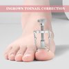 Ingrown Toenail Clippers Removal Kit Pedicure Tools for Feet Pedicure Knife Nail Pliers Treatment Cuticle Cutter