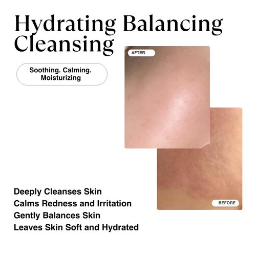 MATKAS Korean Hydrating Foaming Facial Cleanser for Sensitive Skin - 6 Ceramides, 6 Types of Hyaluronic Acid, Vitamin E, Gentle Deep Cleansing Korean Face Wash, Moisturizing Face Cleanser for Dry Skin