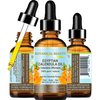 Botanical Beauty CALENDULA OIL Egyptian Calendula Officinalis Marigold Oil Pure Natural for FACE, SKIN, BODY, HAIR, NAILS 2 Fl.oz.- 60 ml Skin Moisturizer Oil