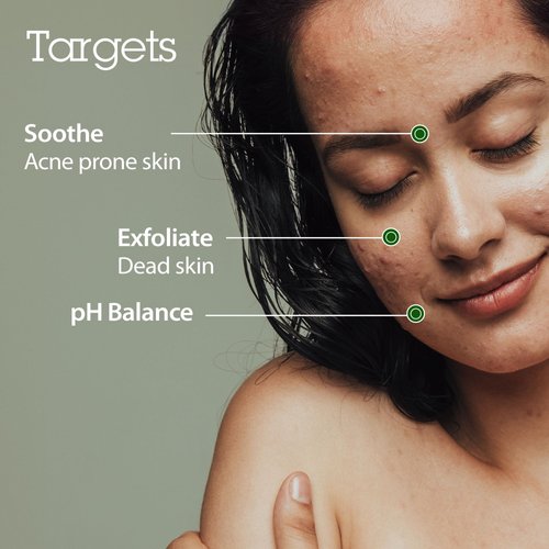 BLITHE Patting Splash Mask Face Exfoliator with Soothing & Healing Green Tea - Lactic Acid Exfoliating Face Wash for Acne Prone Skin, Vegan K Beauty Oil Controlling & Pore Clarifying 5.07 Fl Oz