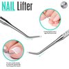 FANDAMEI 4 PCS Nail Care Kit, Cuticle Trimmer, Nail Cuticle Nippers, Ingrown Toenail Removal Kit, Cuticle Kit Stainless Steel, Cuticle Clippers, Cuticle Pushers, Manicure Kit, Pedicure Kit