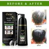 Vedora Instant Black Hair Shampoo 400ml - Semi-Permanent DeXe black Hair Dye shampoo for Natural Hair, Lasts 30 Days, Fast Acting Formula for Men & Women