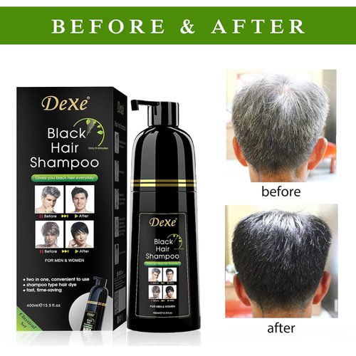 Vedora Instant Black Hair Shampoo 400ml - Semi-Permanent DeXe black Hair Dye shampoo for Natural Hair, Lasts 30 Days, Fast Acting Formula for Men & Women