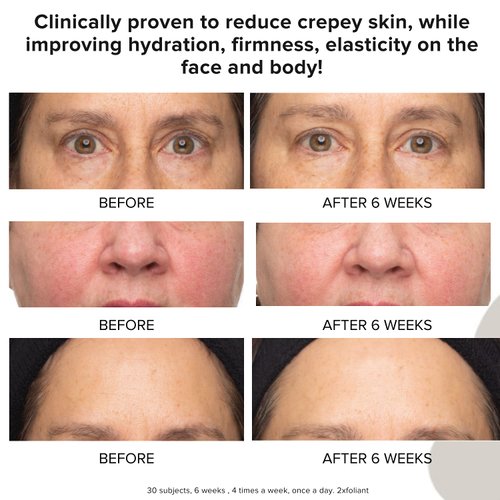 Priori Skincare 2xfoliant Peel + Scrub for Face and Body Lactic Acid Retinol Vitamin C, E At-Home Microdermabrasion Anti-Irritant Dermatologist Tested 6.8 fl oz