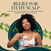 Rosemary and Biotin Organic Pre-Wash Scalp Oil and Hair Treatment Oil: Pre Shampoo Dry Scalp Treatment, Hair Growth Stimulator Serum For Healthy Scalp & Less Hair Fall and Breakage. 2 Fl Oz.