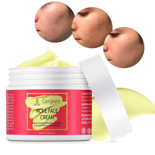 Acne Face Cream, Salicylic Acid Cystic Acne Treatment For Face, Back But, Acne Spot Treatment for Face and Body Pimple, Acne Treatment Cream, Anti-Acne Skincare Cream for Teens & Adults, 3.53 OZ