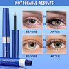 Lash Serum, Rapid Eyelash Growth Serum, Eyelash Serum for Eyelash Growth Thickness, Stronger, Healthier Lashes & Brows, Longer, Fuller, and Thicker Lashes, Vegan & Cruelty-Free (Dark Blue 3ML)