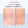 First Aid Beauty Ultra Repair Cream Intense Hydration Moisturizer for Face and Body - 8 oz.