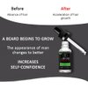 AICHUN BEAUTY Beard Oil Mustache Hair Pure Natural Nutrients Skin Cleansing Vitamins Grapefruit Seed Oil Ginger Andrea Hair 30ml