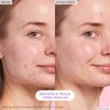 Glow Recipe Blackberry Retinol Face Serum - Anti Aging Night Serum & Pore Minimizer with Hydrating Triple Retinoids to Help Clarify Blemishes, Smooth Texture, Reduce Fine Lines & Wrinkles (30ml)