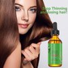Rosemary Hair Growth Oil and Serum - Dry Scalp Treatment, Hair Thickening Products for Women, Hair Loss Essential Oils for Diffuser (2OZ)