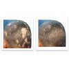 Caboki Healthful Powder Volumizer for Men & Women: Thinning Hair Solution for Root Touch Up, Hairline & Edges, Covering Hair Loss, Bald Spots & Gray Hair - TALC-Free,