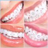 377 Pieces Tooth Gem Kit Tooth Jewelry Kit DIY Fashionable Tooth Artificial Crystal Reflective Tooth for Halloween Christmas Teeth Party Decorations (Stylish Style)