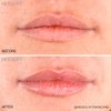 MesoLyft Lips 5 ML (5 ML) Lip Plumper