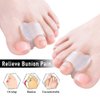 Welnove - 10 Pack Toe Separators Gel Toe Spacers Bunion Corrector（1st/2nd Toe) and Spreader for Bunions, Overlapping Toes and Drift Pain Relief Pads - Clear