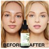 Tea Tree Oil Facial Serum, Acne Serum Soothing & Nourishing Non-Greasy Skin Care Serum Moisturizer Oil Control Tea Tree Serum for Face and Acne Prone Skin Redness Relief, Acne Scars, Pimples