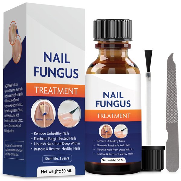 Toenail Fungus Treatment, Nail Fungus Treatment for Toenail, Toe Nail Fungus Treatment Extra Strength, Fungus Nail Treatment, Nail Fungus Treatment for Nail, Fungus Treatment for Fingernails