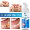 Aligner Cleaner, 2 Pack Denture Cleaner and Whitener Paste Foam Perfect for Sports Mouth Guard and Denture, Fast-Acting Alternative to Retainer Cleaner Tablets, Whitens Teeth and Fights Bad Breath
