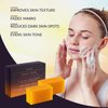 VALITIC 4 Pack Kojic Acid Vitamin C & Retinol Soap Bars for Dark Spot & A Pair of Black Exfoliating Gloves for Body Scrubs
