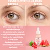Nature Spell Advanced Under Eye Serum with Watermelon & Goji Berries 1 Fl Oz– Targets Dark Circles, Puffiness & Eyebags – Anti Wrinkle Under Eye Cream - 100% Vegan – Made in the UK
