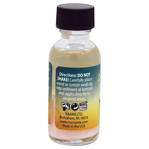 Acne Zap Drying Lotion - Overnight Acne Spot Treatment Dries Out Blemishes, Zits, Whiteheads, Pimples and Blackheads - Extra Strength Natural Solution for Acne Prone Skin - 1 fl oz