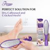 Fivona Foot File - Callus Remover for Feet, Double Sided Foot Rasp for Dry Heels, Feet Scrubber for Dead Skin, Corn Removal for Feet, Foot Scraper
