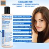 DermaSolve Scalp Psoriasis & Dandruff free Medicated Shampoo with Conditioner, Ultimate Seborrheic Dermatitis Treatment for Itchy, Flakey Scalp, Soothing & Moisturizing Relief