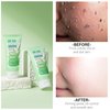 Purifying Exfoliating Gel Peeling Gel Aloe Vera Sparkling Peeling Gel, Deep Cleansing Face Scrub Exfoliating Body Gel Face Wash Facial Scrub Exfoliator Exfoliant Facial, Dead Skin Remover -3.38 FLOZ