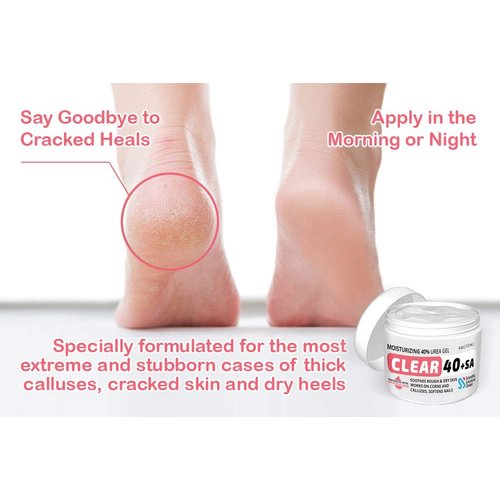 CLEAR Urea Cream 40% +2% Salicylic Acid (4oz) | Softens Cracked Heels & Dry Skin Urea Salicylic Acid Cream- Tea Tree & Coconut Oil | Salicylic Acid Foot Cream for Callus & Corn Treatment | Made in USA
