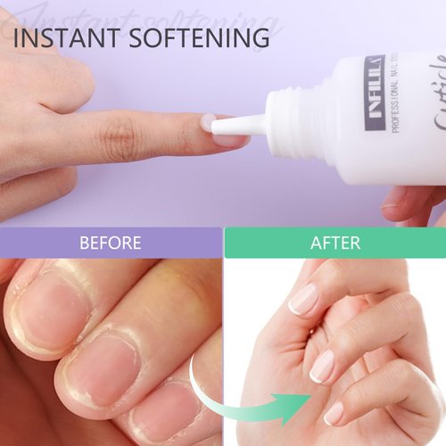 NXJ INFILILA Cuticle Remover, 100ml Cuticle Softener, Instant Cuticle Remover Liquid for Hand, Foot & Nail Care, Salon Quality Cuticle Cream Professional Nail Cuticle Remover Gel Gifts for Women