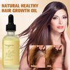 Veganic Natural Hair Growth Oil,2PCS Veganic Hair Growth Oil, Veganic Hair Oil for Hair Growth for Men and Women