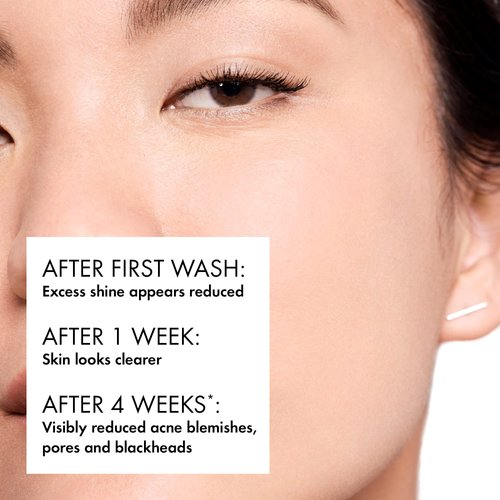 Vichy Normaderm Phytoaction Cleanser 400 ml