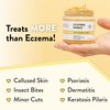 ECZEMA HONEY Original Skin-Soothing Cream - Organic Hand & Body Eczema Relief - Natural Honey Lotion for Dry, Itchy, & Irritable Skin (4 Oz)