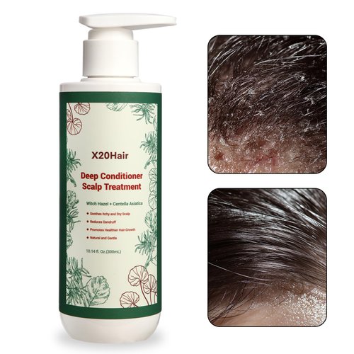 Deep Conditioner Scalp Treatment - Comprehensive Relief for Seborrheic Dermatitis, Psoriasis, and Dandruff | Soothes Dry, Itchy Scalp & Balances Oily Hair for Women