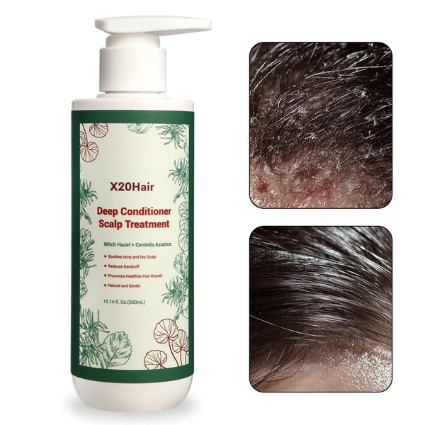 Deep Conditioner Scalp Treatment - Comprehensive Relief for Seborrheic Dermatitis, Psoriasis, and Dandruff | Soothes Dry, Itchy Scalp & Balances Oily Hair for Women