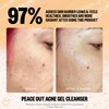 Peace Out Skincare Acne Gel Cleanser, Boost Skin Barrier and Help Diminish Blemishes, Daily Acne Face Wash with Salicylic Acid for Men and Women, 4 fl oz