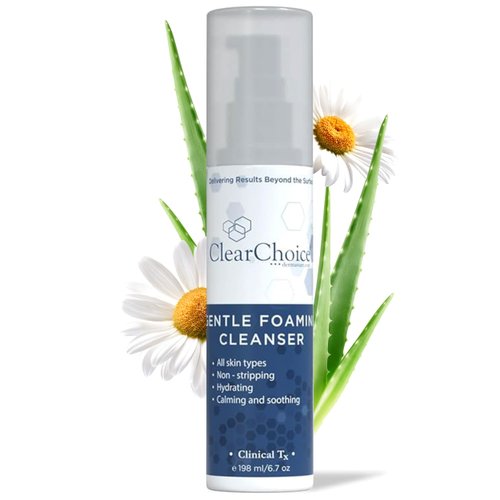 Clear Choice Gentle Foaming Cleanser 6.7oz – Soap-Free, SLS-Free Face Wash for Sensitive, Acne-Pr...