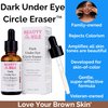 Dark Under Eye Circle Eraser™ Vitamin C+ Serum for Skin-of-Color, Dark Circle Puffiness Wrinkle Hyaluronic Acid Superoxide D, Beauty of the Nile® 1 Oz
