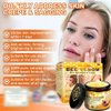 Bee Venom Skin Restoration Cream, Bee Venom Skin Treatment Cream, Repair and Wrinkle Reducing Comprehensive Moisturizer for All skin Types 2PC