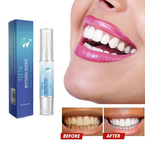 3Pcs LANTHOME Teeth Whitening Essence, Teeth Stain Remover to,Purely White Deluxe Teeth Whitening Kit Pen.