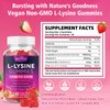 2 Pack L-Lysine 1000mg Gummies for Immune Support & Skin Health - High Potency Vegan Gummies, Sugar-Free, Natural Berry Flavor, Gluten-Free Chewable Supplement for Adults & Kids - 120 Gummiess